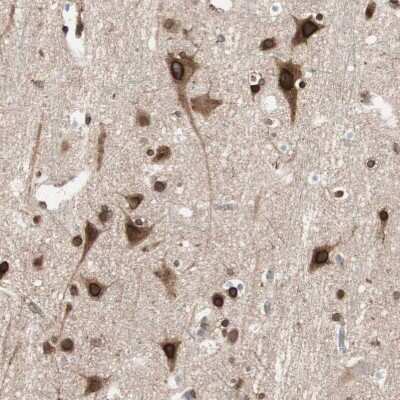 Immunohistochemistry-Paraffin: NUP62 Antibody [NBP1-85091]