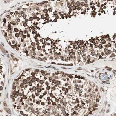 Immunohistochemistry-Paraffin: NUP62 Antibody [NBP1-85091]