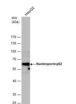 Western Blot: NUP62 Antibody [NBP1-31381]