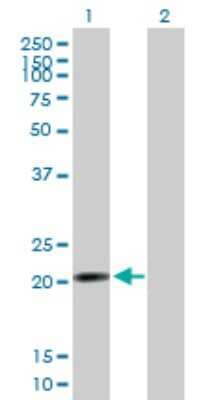 Western Blot: NUP62CL Antibody [H00054830-B01P]