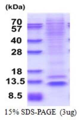 SDS-PAGE: Recombinant Human NUP62CL His Protein [NBP2-51621]