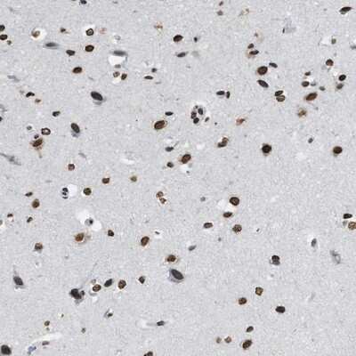Immunohistochemistry-Paraffin: NUP88 Antibody [NBP1-82658]