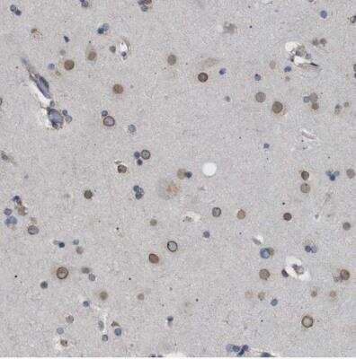 Immunohistochemistry-Paraffin: NUP93 Antibody [NBP1-81546]