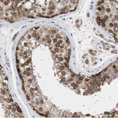 Immunohistochemistry-Paraffin: NUP93 Antibody [NBP1-81546]