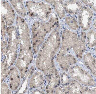 Immunohistochemistry-Paraffin: NUP93 Antibody [NBP1-81546]