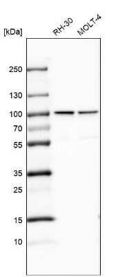 Western Blot: NUP93 Antibody [NBP1-81546]