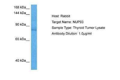 Western Blot: NUP93 Antibody [NBP2-83296]