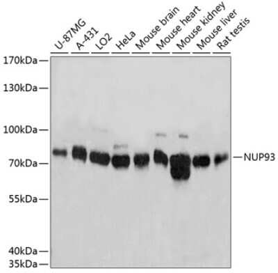 Western Blot: NUP93 AntibodyAzide and BSA Free [NBP2-94888]