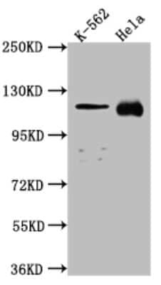 Western Blot: NUP98 Antibody (2H4) [NBP3-15200]