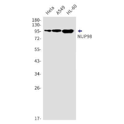 Western Blot: NUP98 Antibody (S01-6F4) [NBP3-15070]