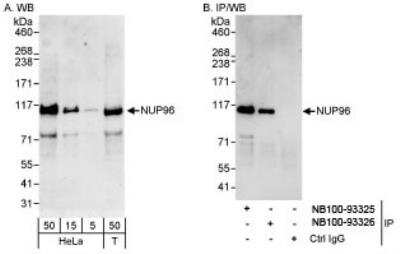 Western Blot: NUP98 Antibody [NB100-93325]