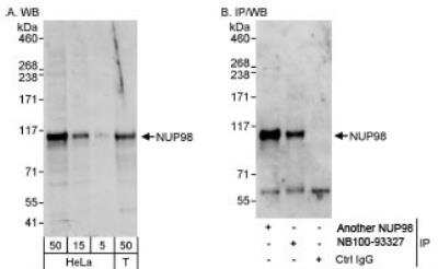 Western Blot: NUP98 Antibody [NB100-93327]