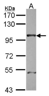 Western Blot: NUP98 Antibody [NBP2-19612]