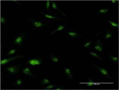 Immunocytochemistry/ Immunofluorescence: NUPL1 Antibody (3G11) [H00009818-M01]