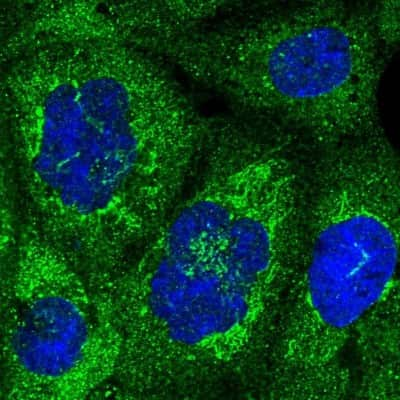 Immunocytochemistry/ Immunofluorescence: NUPL1 Antibody [NBP2-13684]