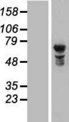 Western Blot: NUPL1 Overexpression Lysate [NBL1-13884]