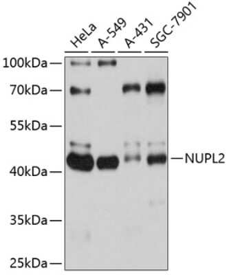 Western Blot: NUPL2 AntibodyAzide and BSA Free [NBP2-94275]