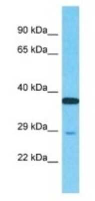 Western Blot: NUPL2 Antibody [NBP3-09511]