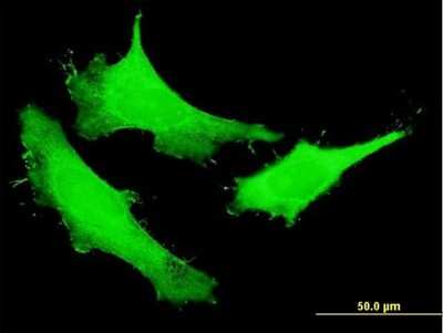 Immunocytochemistry/ Immunofluorescence: NUSAP1 Antibody [H00051203-B01P]