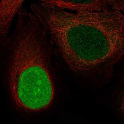 Immunocytochemistry/ Immunofluorescence: NUSAP1 Antibody [NBP2-68989]