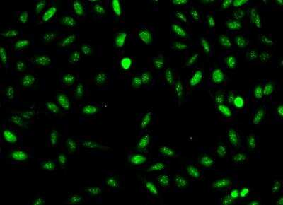 Immunocytochemistry/ Immunofluorescence: NUSAP1 Antibody [NBP3-06564]