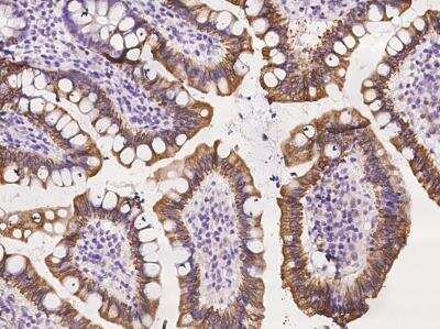 Immunohistochemistry-Paraffin: NUSAP1 Antibody [NBP3-06564]