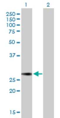 Western Blot: NUSAP1 Antibody [H00051203-B01P]