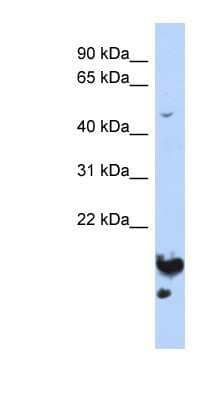 Western Blot: NUSAP1 Antibody [NBP1-53047]