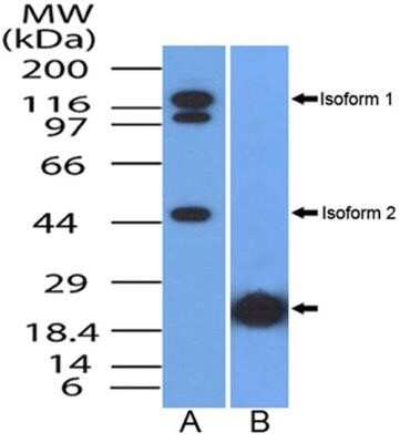 Western Blot: NUT Antibody (1G6)Azide and BSA Free [NBP2-80886]