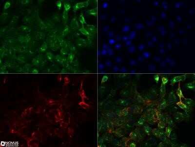 Immunocytochemistry/ Immunofluorescence: NUT Antibody (2B6) - Azide and BSA Free [NBP2-80887]