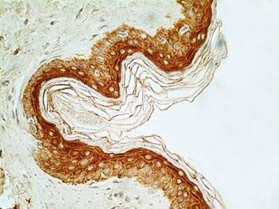 Immunocytochemistry: NUT Antibody (2B6) - Azide and BSA Free [NBP2-80887]