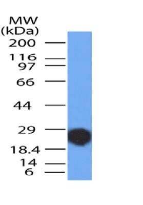 Western Blot: NUT Antibody (2B6)Azide and BSA Free [NBP2-80887]