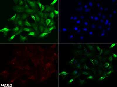 Immunocytochemistry/ Immunofluorescence: NUT Antibody (1G6) - BSA Free [NBP2-31146]