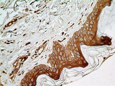 Immunohistochemistry-Paraffin: NUT Antibody (1G6) - BSA Free [NBP2-31146]