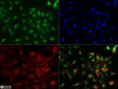 Immunocytochemistry/ Immunofluorescence: NUT Antibody [NBP2-31370]