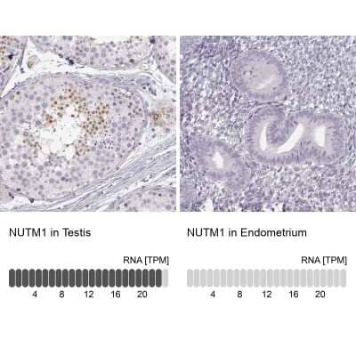 Immunohistochemistry-Paraffin: NUT Antibody [NBP1-84176]