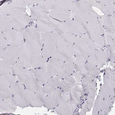 Immunohistochemistry-Paraffin: NUT Antibody [NBP1-84176]