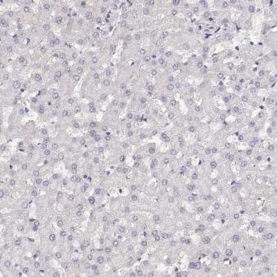 Immunohistochemistry-Paraffin: NUT Antibody [NBP1-84176]