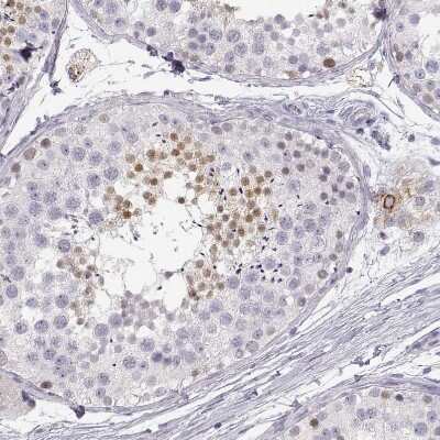 Immunohistochemistry-Paraffin: NUT Antibody [NBP1-84176]
