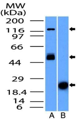 Western Blot: NUT Antibody [NBP2-31370]