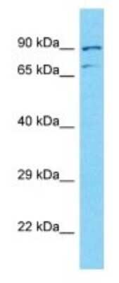 Western Blot: NUTM2A Antibody [NBP3-09707]