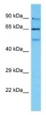 Western Blot: NUTM2B Antibody [NBP3-09918]