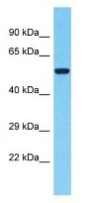 Western Blot: NUTM2F Antibody [NBP3-09708]