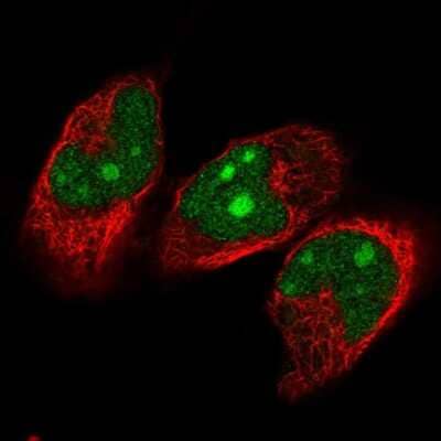 Immunocytochemistry/ Immunofluorescence: NVL Antibody [NBP2-58764]