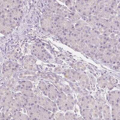 Immunohistochemistry-Paraffin: NVL Antibody [NBP2-37861]