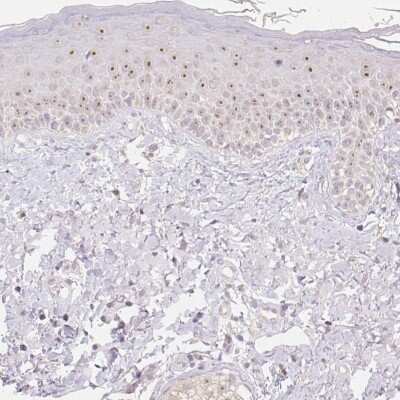Immunohistochemistry-Paraffin: NVL Antibody [NBP2-37861]