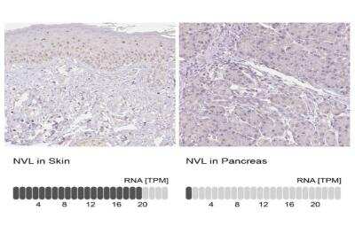 Immunohistochemistry-Paraffin: NVL Antibody [NBP2-37861]