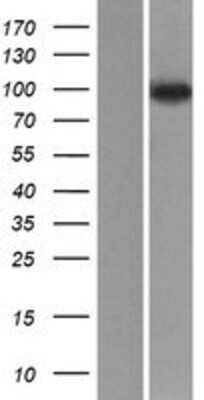 Western Blot: NVL Overexpression Lysate [NBP2-08104]