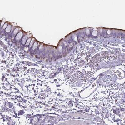 Immunohistochemistry: NWD2 Antibody [NBP2-47350]