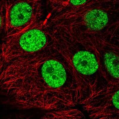 Immunocytochemistry/ Immunofluorescence: NXF1 Antibody [NBP2-49341]